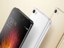  Xiaomi Mi 5s      