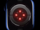 Apple создала ИИ, который определяет состояние здоровья человека с точностью до 92 %