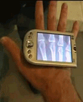 Portable X-Ray Portable X-Ray